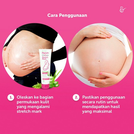 Mama's Choice Stretch Mark 100mL - Krim Penyamar garis di kulit jeruk parut Perut Ibu Mama' Choice 100 ml