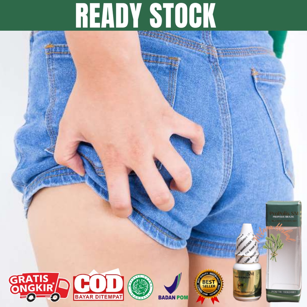 Obat Gatal Menahun, Gatal-Gatal Bokong, Gatal Selangkangan, Gatal Di Penis, Gatal Di Area Bokong/Pan
