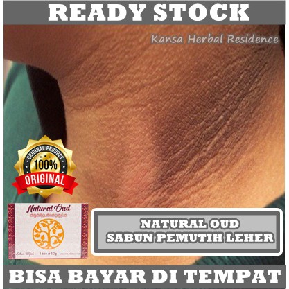 Sabun Pemutih Leher Hitam, Obat Memutihkan Tengkuk Leher Yang Hitam, Cream Penghilang Kulit Hitam Di