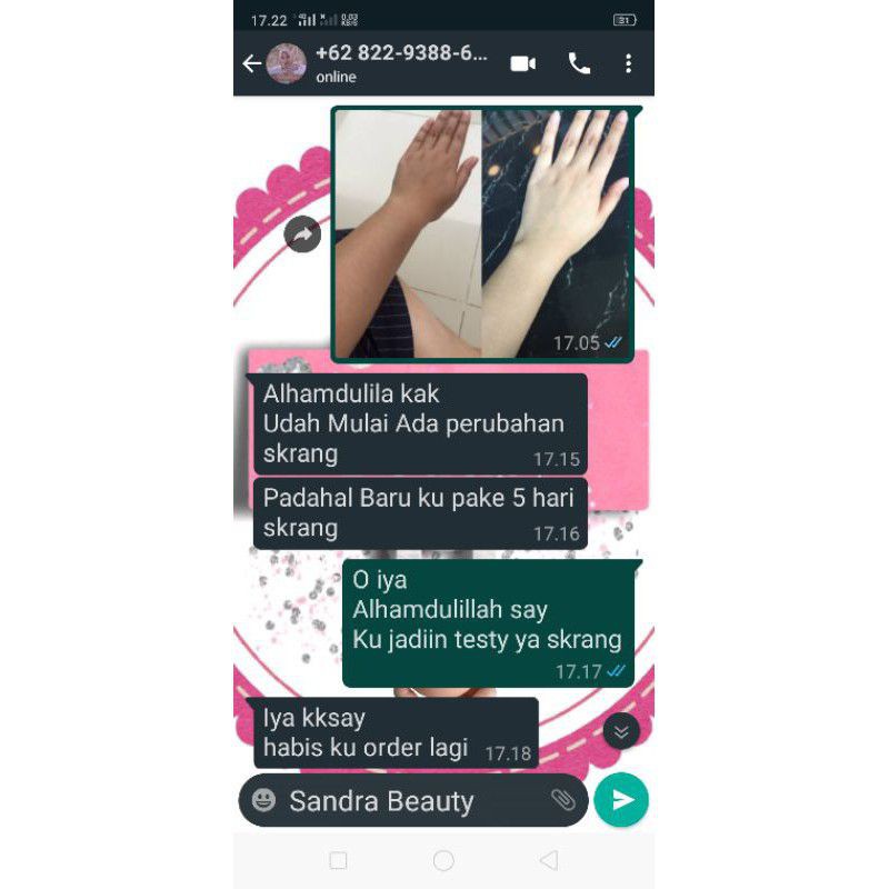 putih dalam 5 hari HB racik super dosting