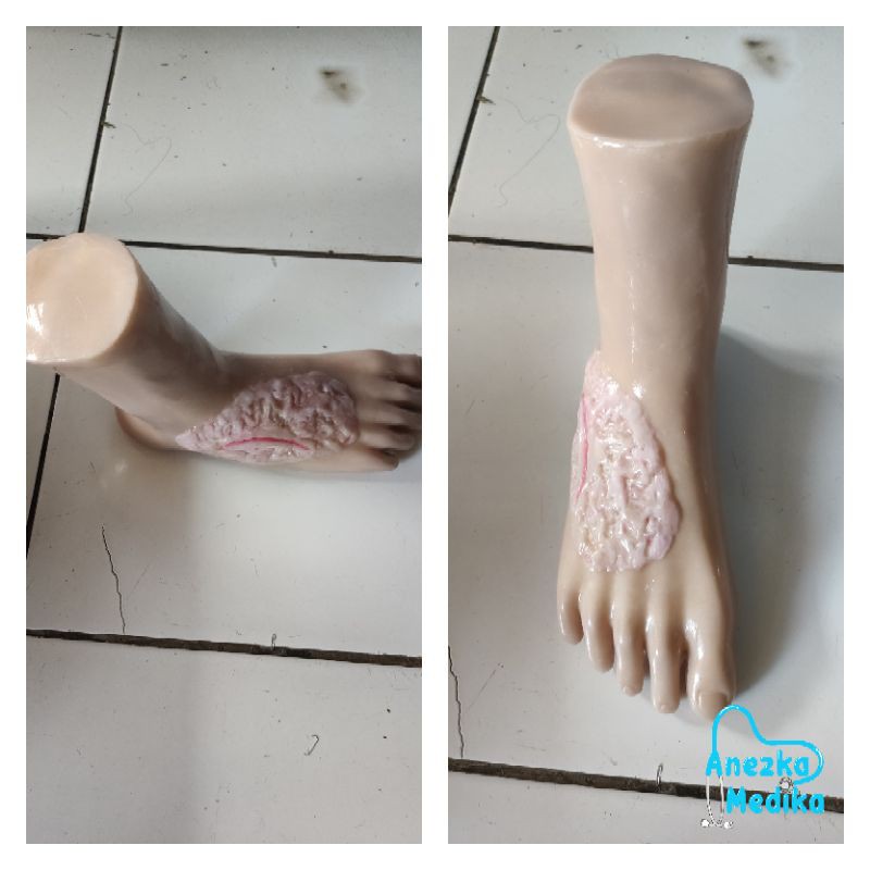 PHANTOM MANIKIN MODEL KAKI LUKA