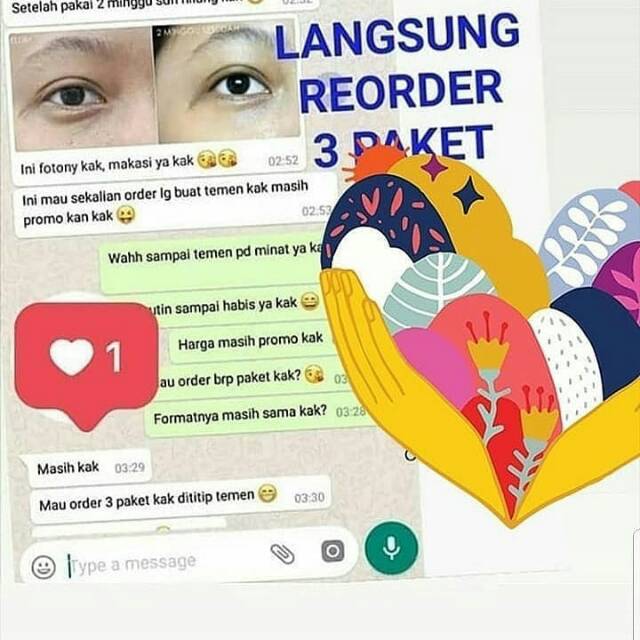 Penghilang Mata Panda EYE LIFT TREATMENT