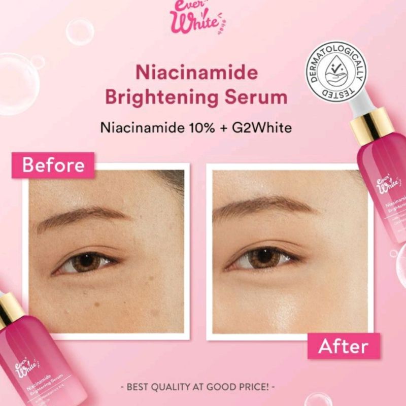 C Everwhite Niacinamide Brightening Serum ( Untuk Noda Hitam)