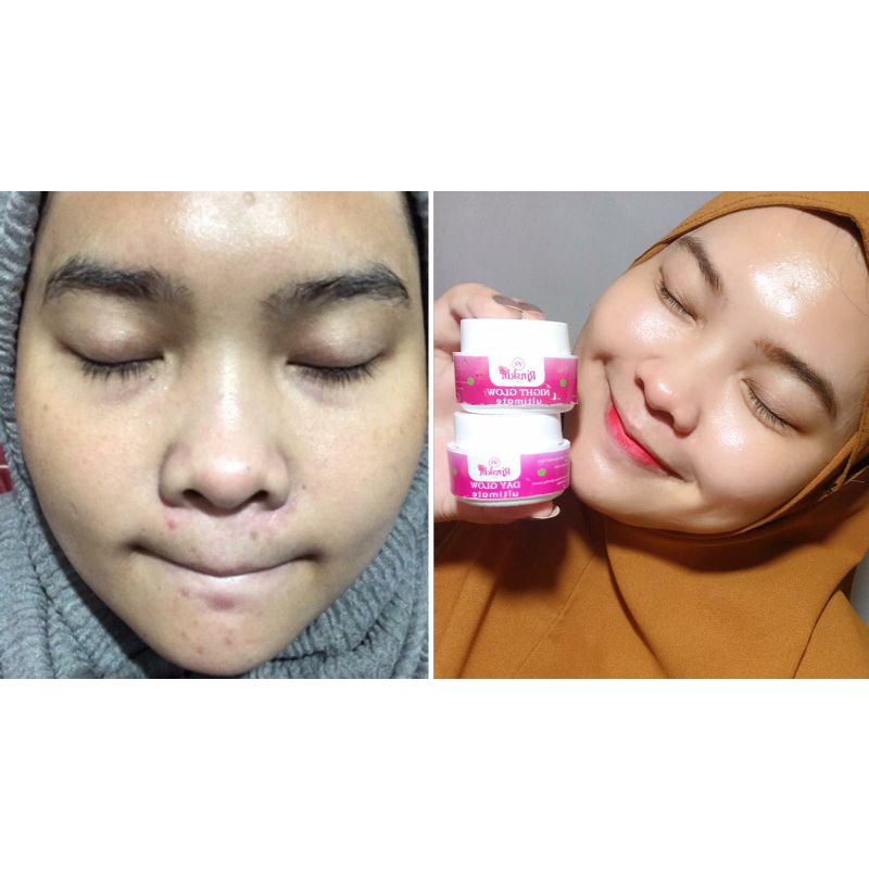 NIGHT CREAM NRGLOW CREAM CREAM MALAM FLEK TEBAL AMPUH PUTIH CEPAT