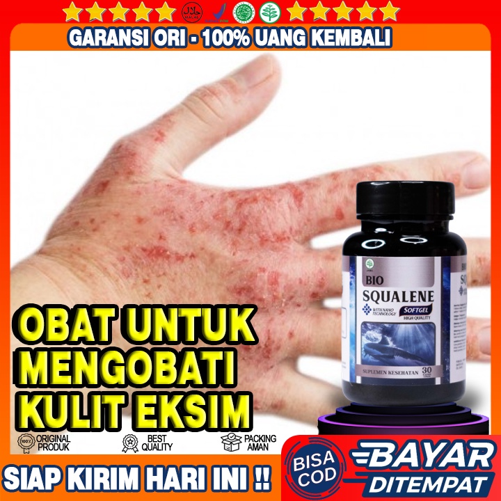 Obat Eksim Kulit - Obat Kulit Gatal Gatal - Obat Eksim Kering Menahun - Obat Dermatitis Gatal - Obat