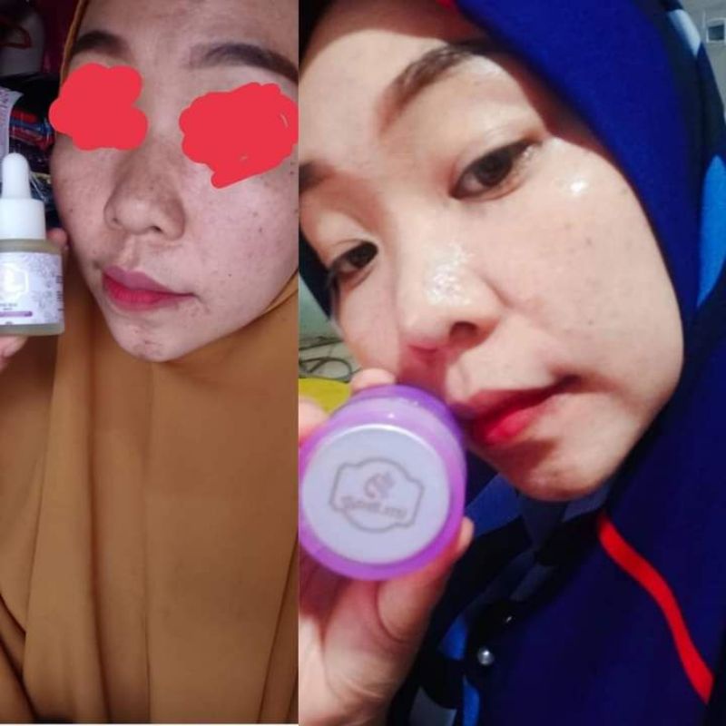 krim all in one UBC...by umi alfatih..