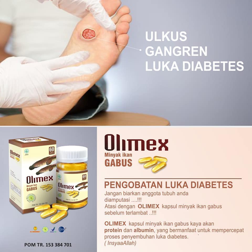 Kapsul Ekstrak Ikan Gabus Kutuk Olimex - Kapsul Pasca Operasi ASLI 100% - Ekstrak Albumin Albusmin Sari Kutuk Ikan Gabus Luka 5x Lebih Cepat Kering Asi Booster - olimax