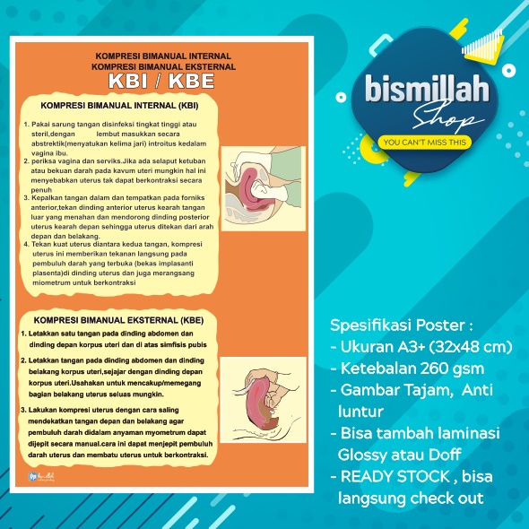Poster Kebidanan KBI/KBE