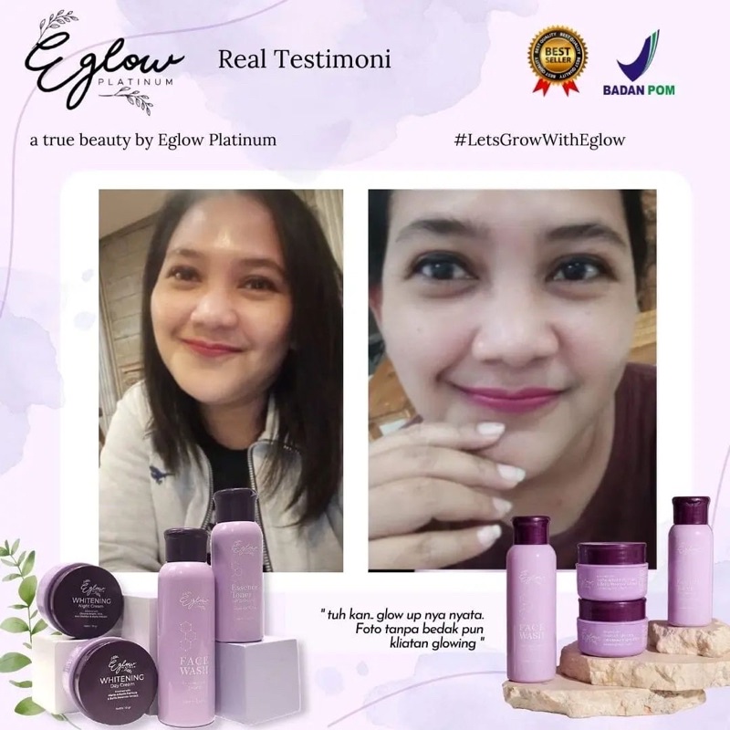 EGLOW PLATINUM PEMUTIH WAJAH PENGHILANG JERAWAT PENGHILANG FLEK KUSAM EGLOW ORIGINAL EGLOW BPOM PAKET WHITENING ACNE ULTIMATE