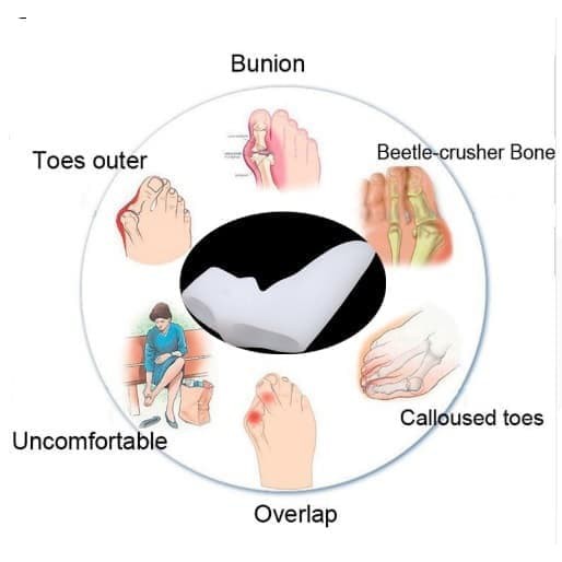 Silicone Gel Pelindung Bunion dan Pengurang Hallux Valgus 002