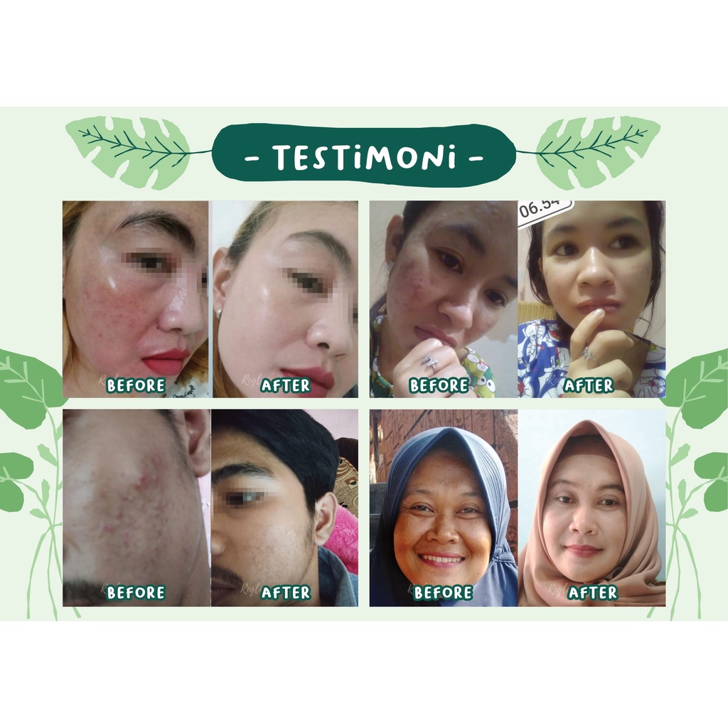 Reglow Paket Whitening