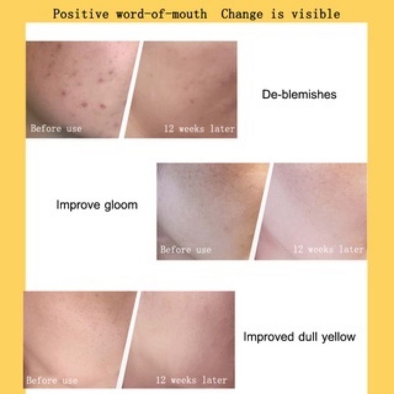 [BPOM] 100 % Original NOBB！Vitamin C Facial Serum Lotion