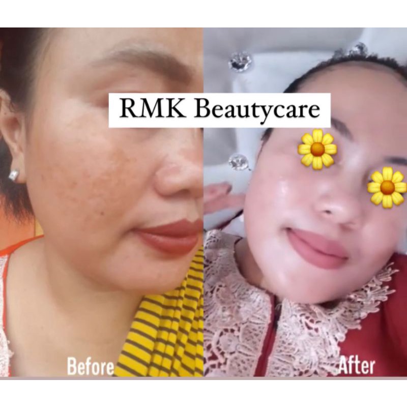 paket whitening BOOSTER / SENSITIF cream pemutih kulit kebal susah putih rmk / cream pemutih wajah kusam kering / kusam berminyak