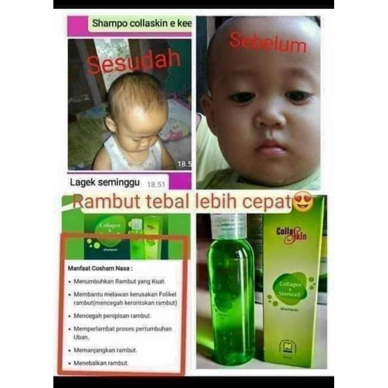 shampo collaskin nasa#sampo penumbuh rambut bayi