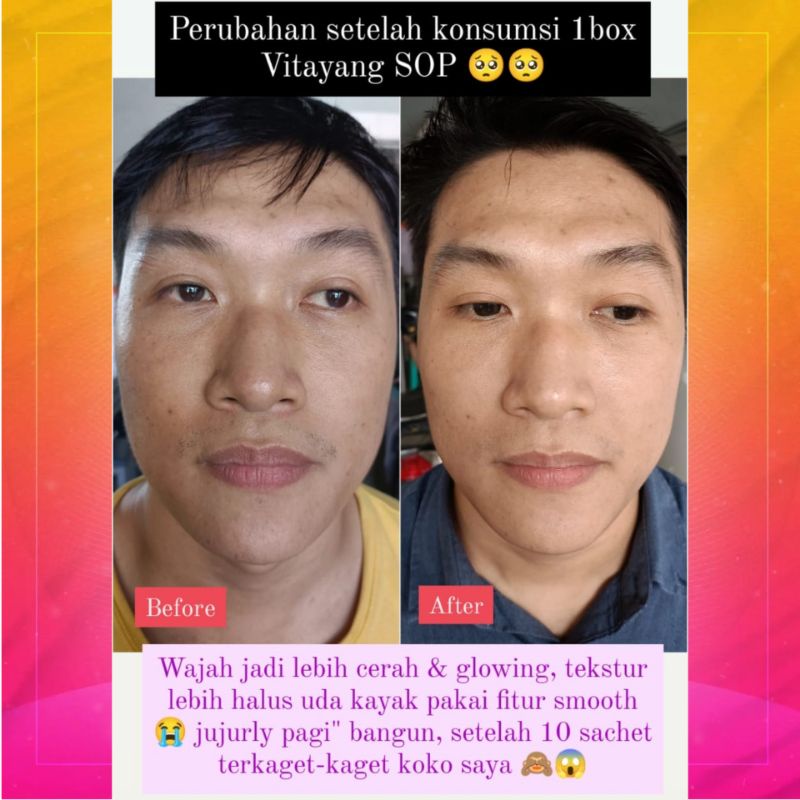 Vitayang SOP Salmon Ovary Peptide Minuman Kecantikan dari Jepan Menghilangkan Flek jerawat Mencerahkan wajah Suplemen Kesehatan Collagen Original KK Indonesia