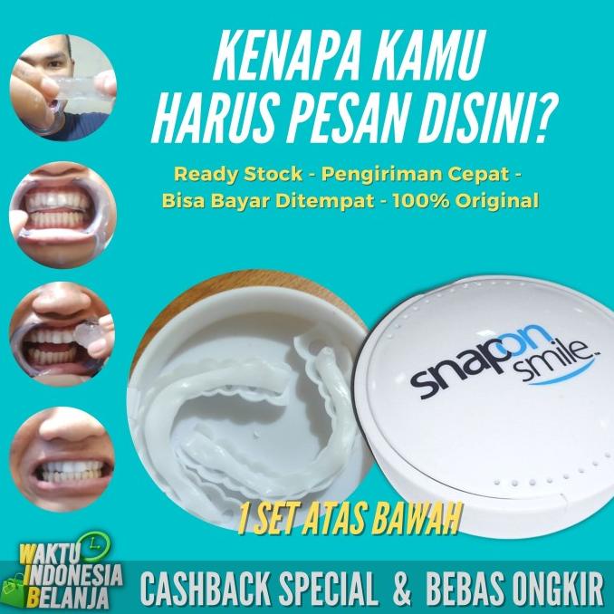 Jual Snap On Smile Venners Gigi Original Set Atas Bawah Gigi