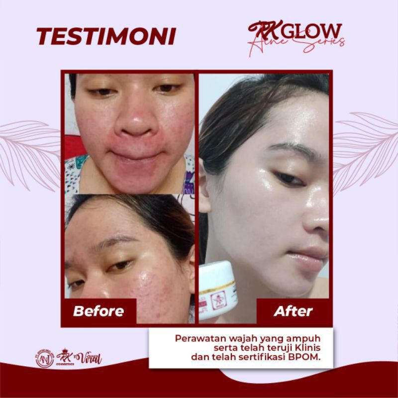 RK GLOW PAKET LENGKAP ORI BPOM ✔️