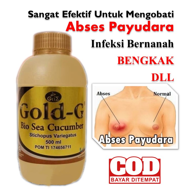 Obat Abses Payudara, Bengkak, Infeksi, Bernanah