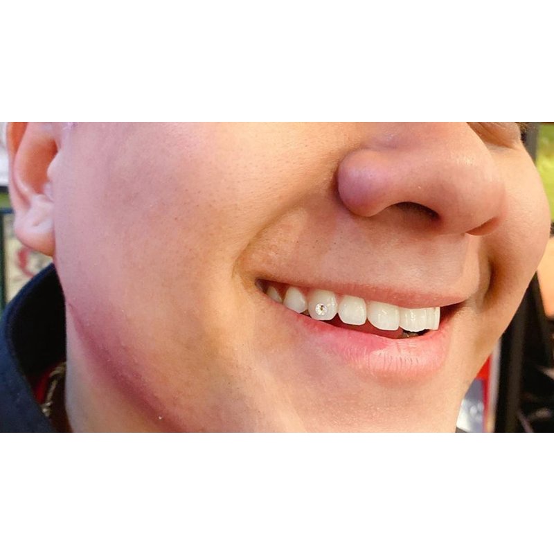 Berlian Gigi Motif Coating Diamond