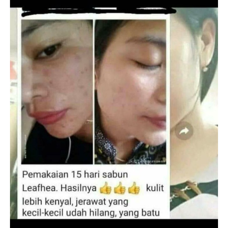 Sabun leafhea/skincare leafhea/sabun wajah