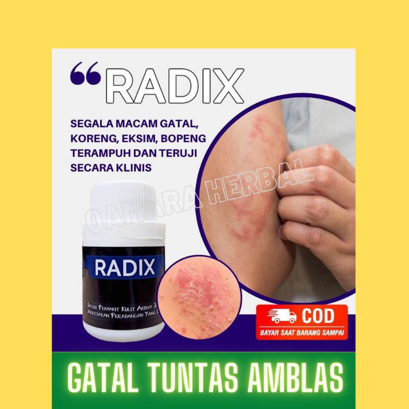 (COD) RADIX- 3X DI OLES 7 HARI GATAL KORENG EKSIM HILANG PERMANEN TUNTAS TANPA BEKAS | GATAL EKSIM T