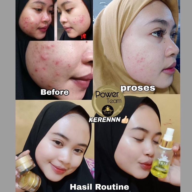 HYDE BEAUTY SKINCARE PAKET GLOWING PEMUTIH WAJAH PENGHILANG FLEK JERAWAT ORIGINAL BPOM HYDE SKINCARE ORIGINAL