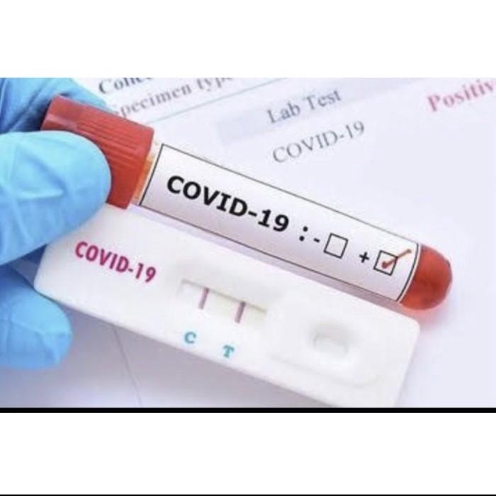 Diagnosa / Swab Antigen/Lungene Biru Akl Orii