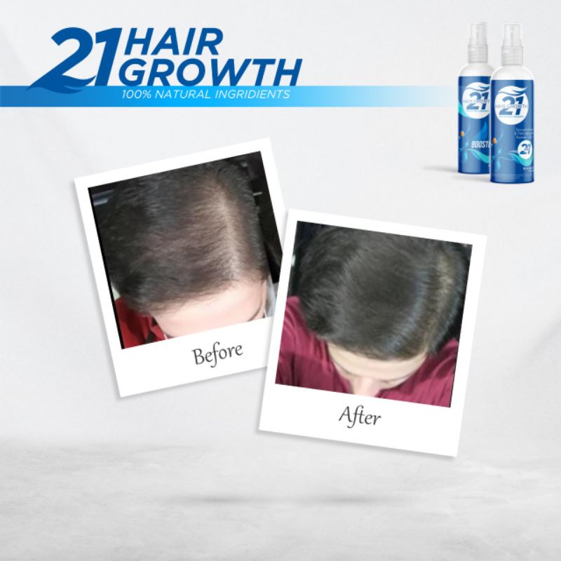 Serum Pemanjang &amp; Penumbuh Rambut tercepat No1 Di Indonesia, 2CM/5 Hari Perawatan Rambut Rontok Parah Pria Wanita anak