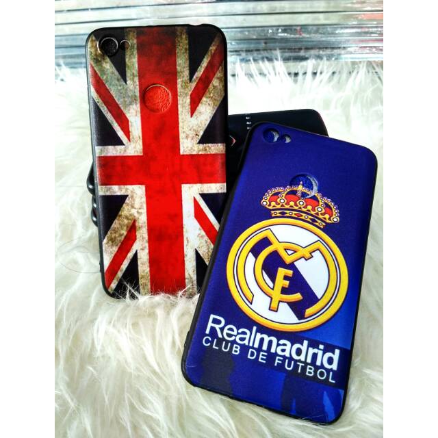 Xiaomi Note 5a Prime Mi note 5a Man Case