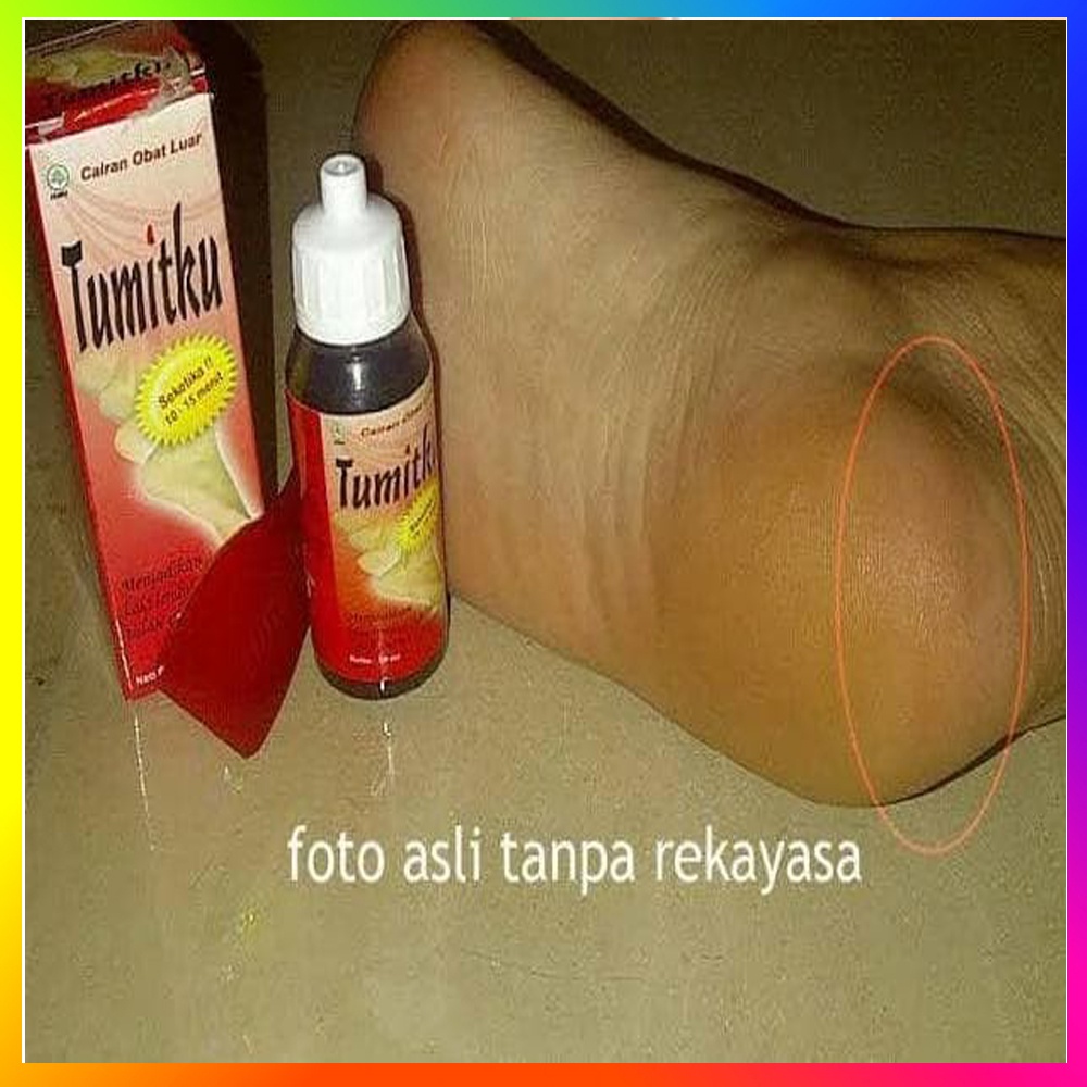 Tumitku 30ml Mengatasi Kaki Pecah &amp; Kapalan obat kaki kapalan Pecah Pecah