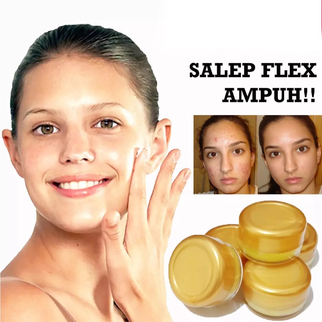 SHINE STAR - Salep Flek Hitam Melasma Ampuh / Salep Wajah Menghilangkan Flex Hitam Dan Jerawat