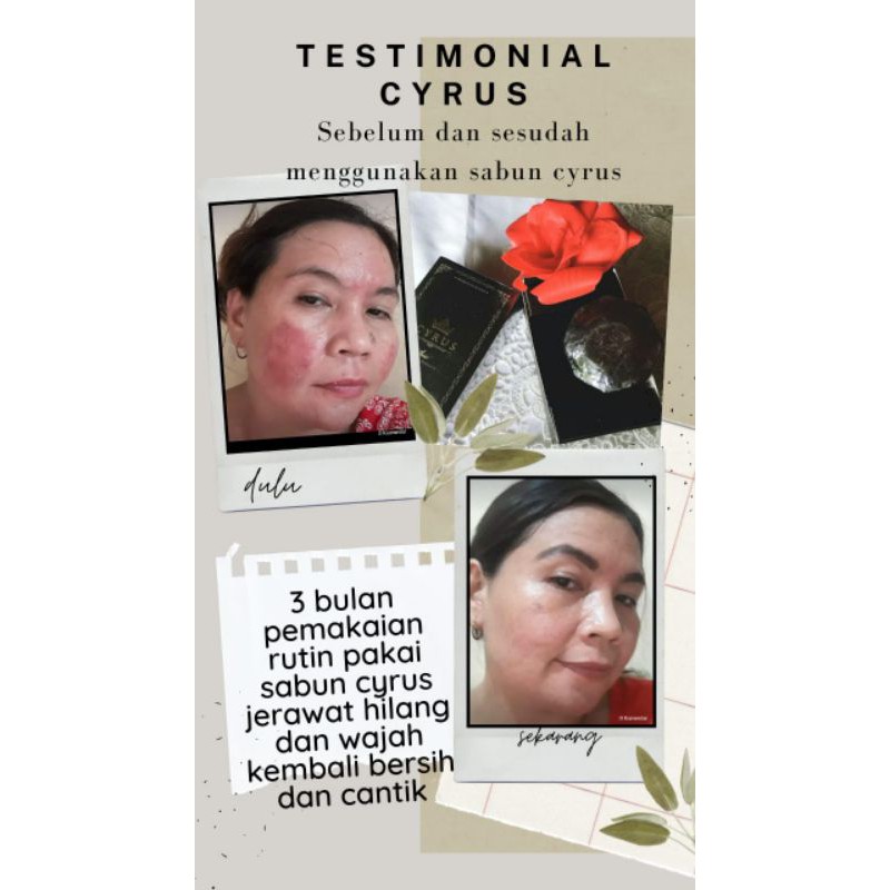 Sabun Cyrus Pembersih Wajah Cocok utk Semua Jenis Kulit Free Tempat Sabun