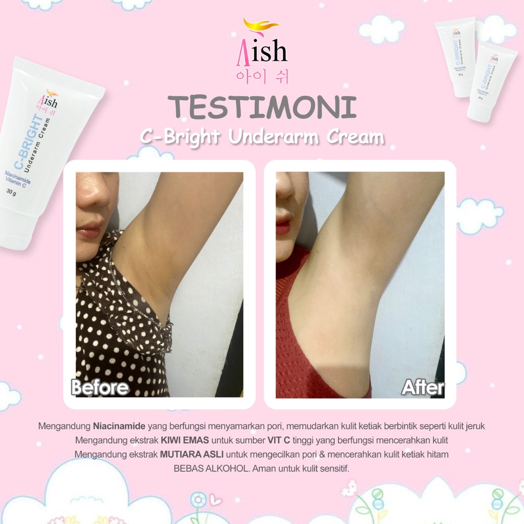 AISH KRIM KETIAK / AISH KRIM SELAKANGAN / BISA COD! AISH UNDERARM CREAM / AISH C BRIGHT AISH C BRIGHT UNDERARM CREAM / AISH UNDERARM KOREA / AISH NECK SERUM / C BRIGHT KETIAK ORIGINAL ORI 100%