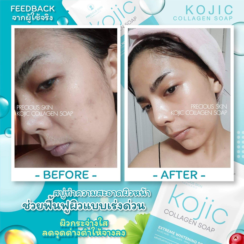 Precious Skin Kojic Extreme Whitening Collagen Soap / Sabun Colagen / Soap/ Sabun / Pemutih Badan 60