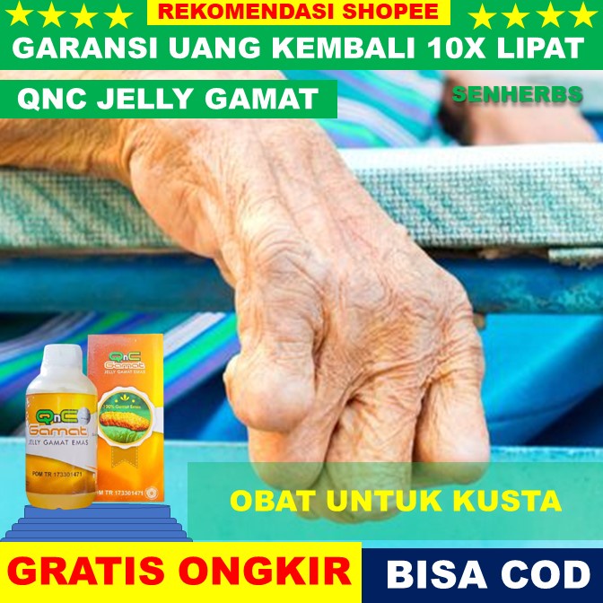 Jual obat kusta Obat Herbal Penyakit Kusta, Kusta Kering Dan Basah