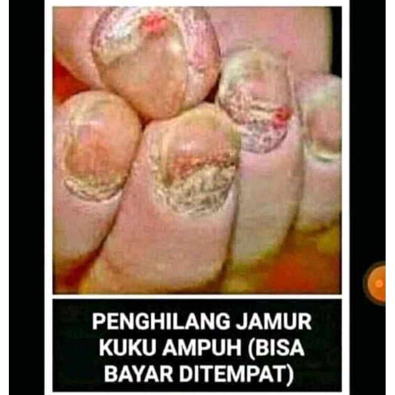 PENGHILANG JAMUR KUKU