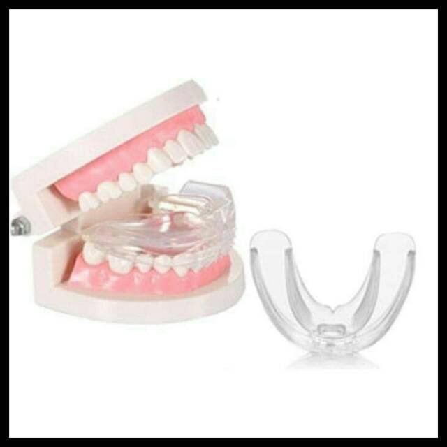 READY STOK!!Perapat perata gigi Behel perapih gigi Orthodontic Rentainer Trainer