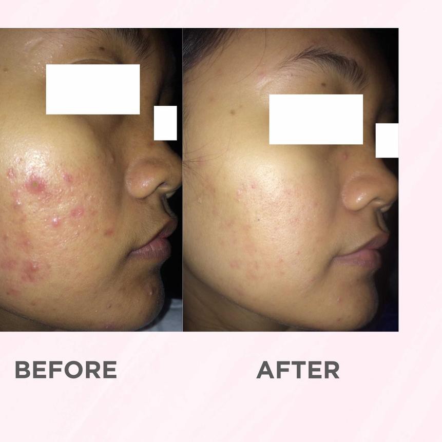 ☃ Airnderm Aesthetic Niacinamide Gel (by AIRIN BEAUTY) ۩