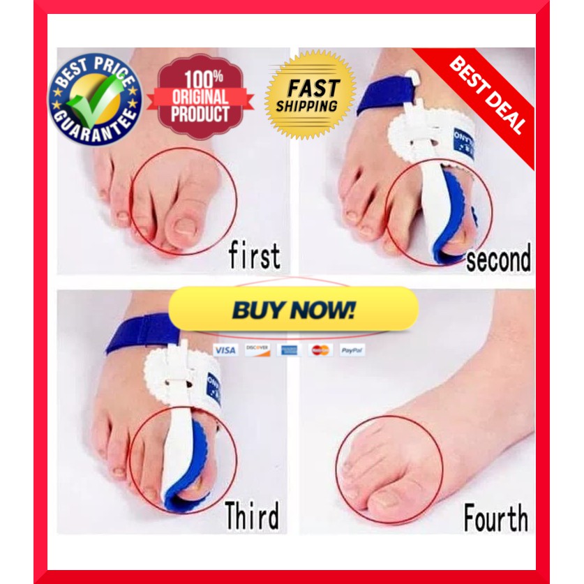 Original 1 pair Bunion hallux valgus orthopedic corrector /anti lecet jari kaki Exp Baru