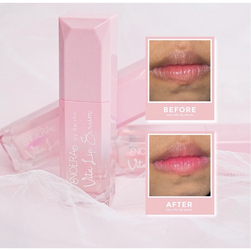 NOERA Vita Lip Serum, Lip serum noera, Lip gel Noera, Vitalip serum Bibir