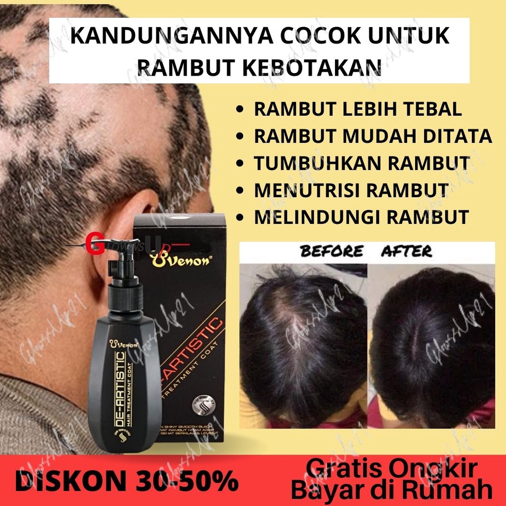 SERUM PELURUS RAMBUT VENON HITAM VITAMIN RAMBUT AMPUH ATASI RAMBUT RONTOK ORIGINAL PERAWATAN RAMBUT