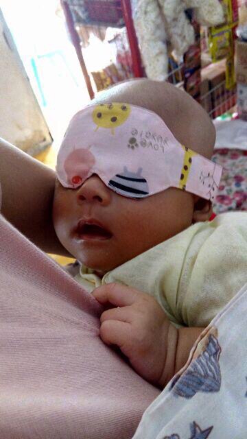 Kaca mata jemur bayi / Eye mask baby / kacamata jemur bayi / pelindung mata bayi