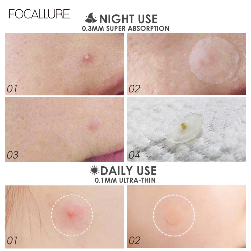 FOCALLURE Spot Patch Acne Treatment Day/Night Untuk Wajah FA186