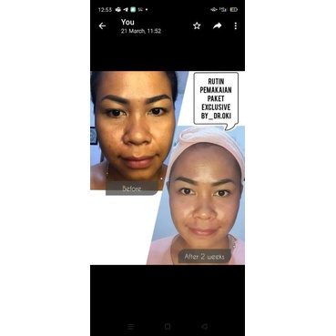 paket exclusive Bening skincare