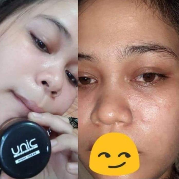 1.1 (Sale)[LR 011]|UNIC SKINCARE BPOM