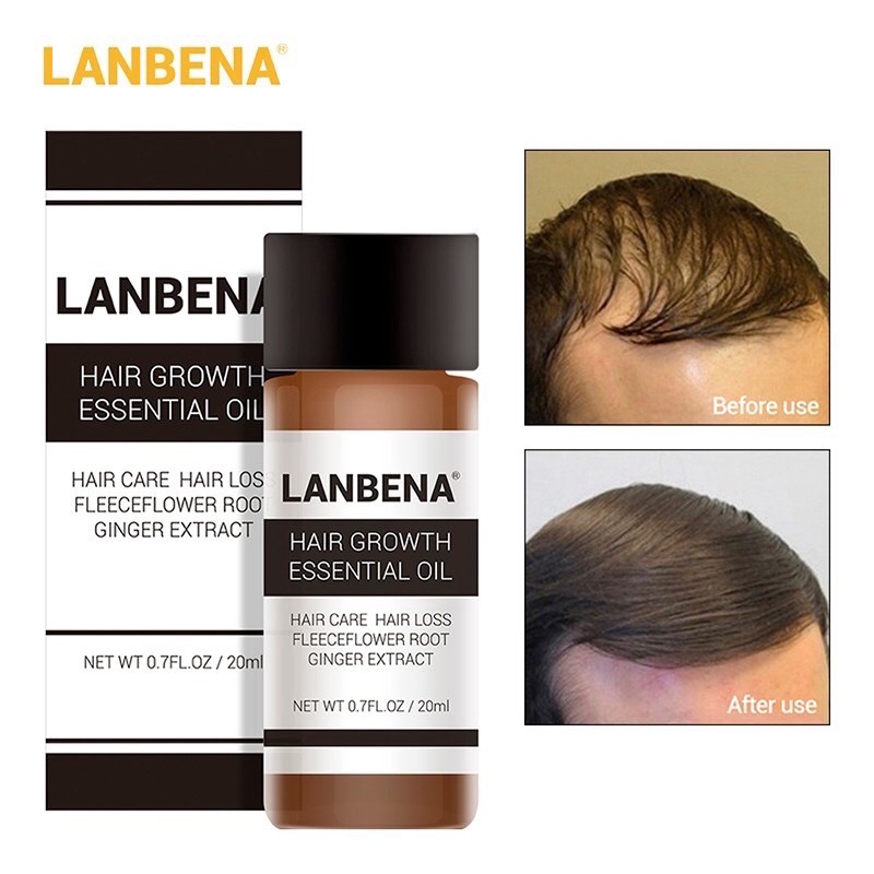 LANBENA serum penumbuh rambut herbal / lanbena hair growth serum