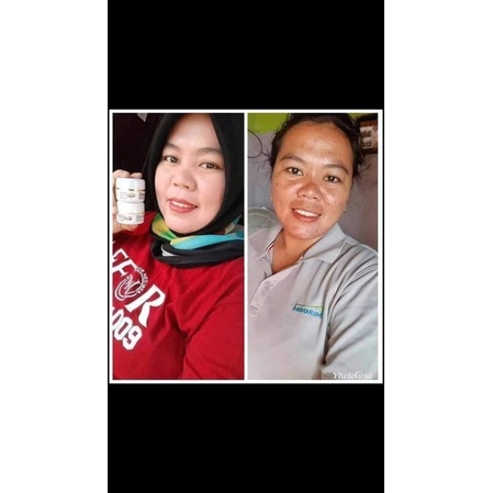 Rk glow Premium/ Rk glow acne (Distributor resmi PT ANJ) di jamin keasliannya