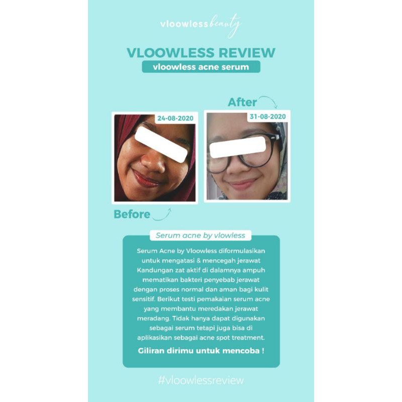 vloowless acne serum