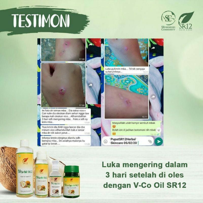 

VCO OIL SR12 MINYAK KELAPA MURNI VIRGIN COCONUT OIL IMUN BOOSTER UNTUK KESEHATAN