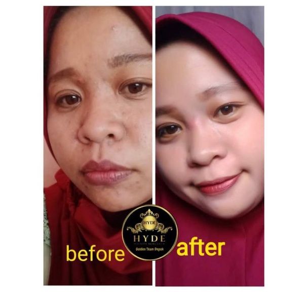 Hyde beauty skincare Facial Wash | Toner | Night Cream | Day Cream